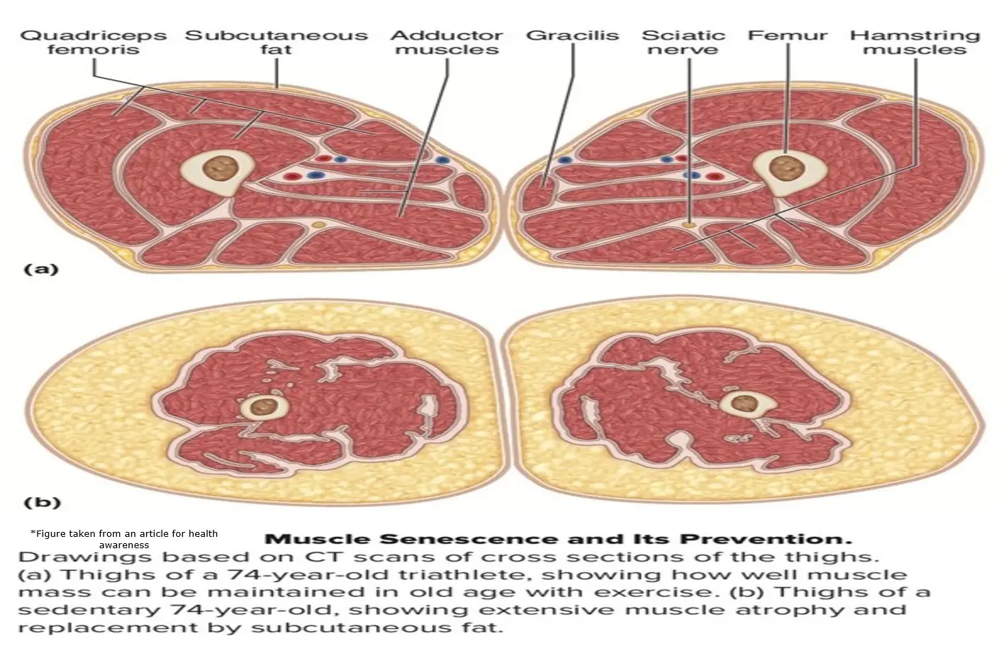 active muscle Sedentary Atrophied Tissues Photo