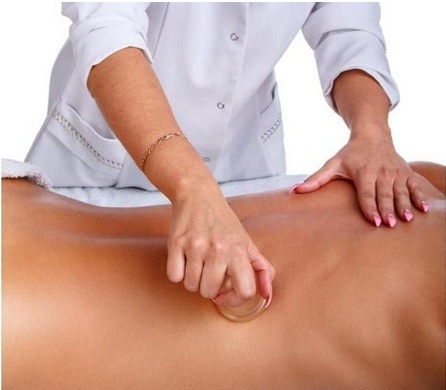 Therapist performing dry cupping on a patient