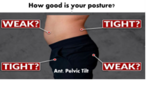 at Tam physio and Rehab clinic Sharjah our therapist treat postural abnormalities