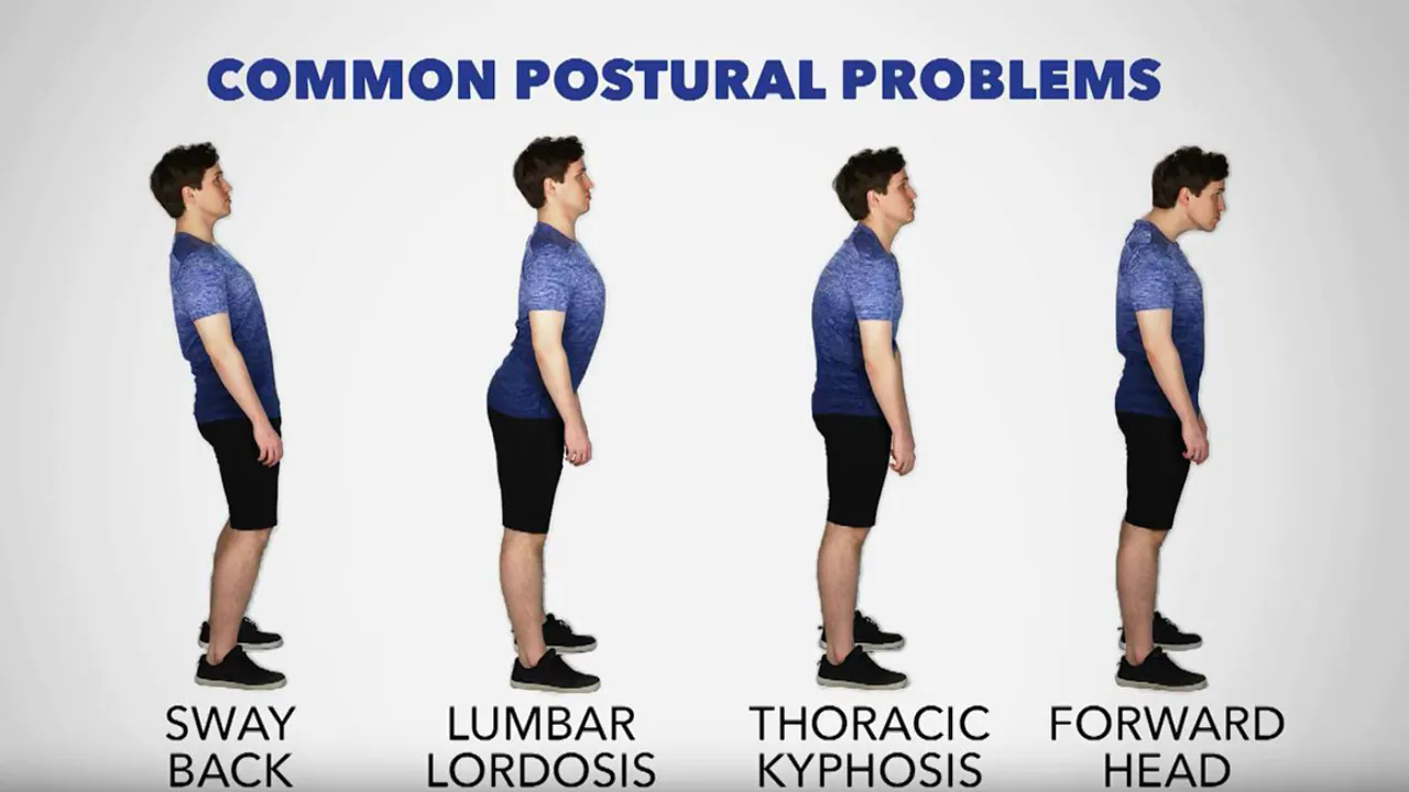 In-Appropriate-postures-studied-throughly-and-treated at-Tam-Physio-Rehab-Clinic-Sharjah