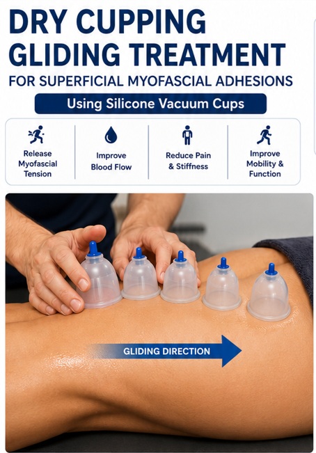 Dry-Glidinging-Cupping-for-superficial-myofascial Adhesions