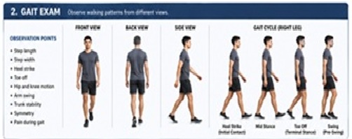 GAIT ANALYSIS
