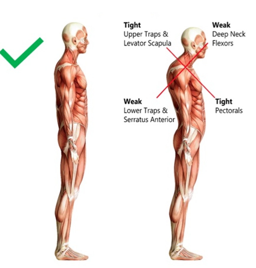 Posture Analysis done at TAM Physio and Rehab Clinic Sharjah - UAE
