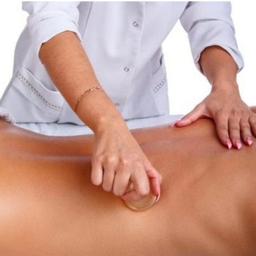 Therapist performing dry cupping on a patient